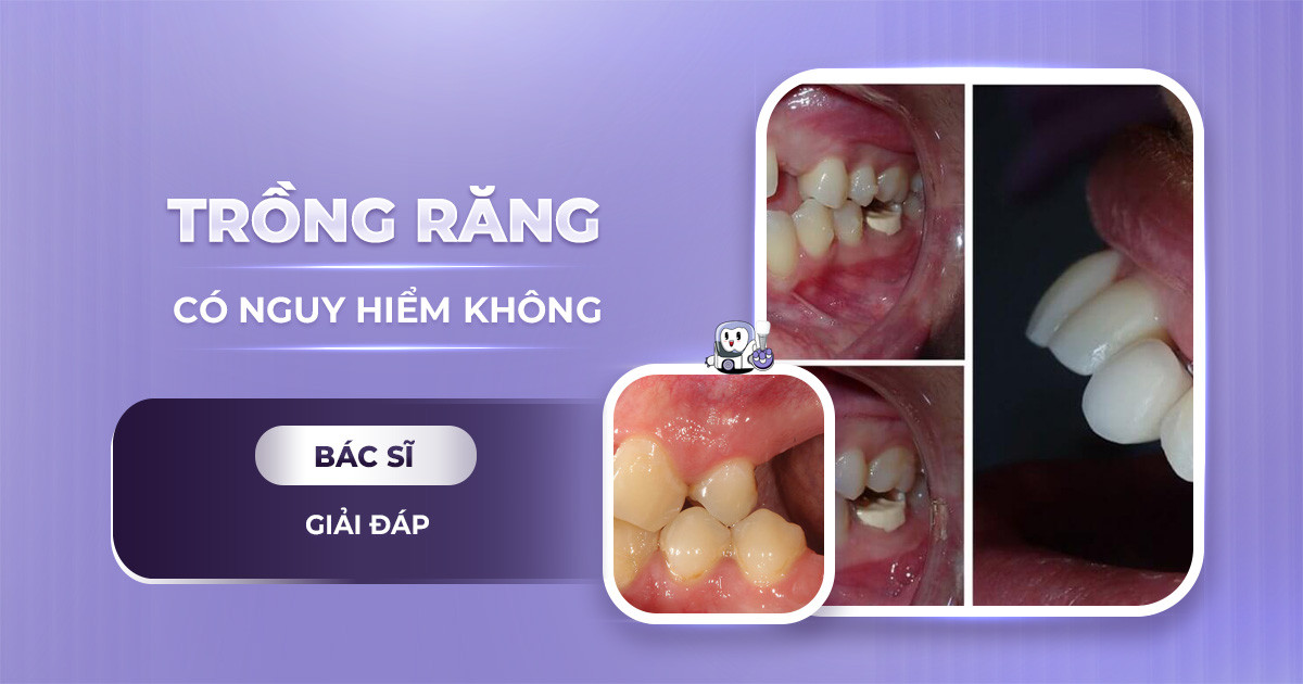 Trồng răng implant có nguy hiểm không