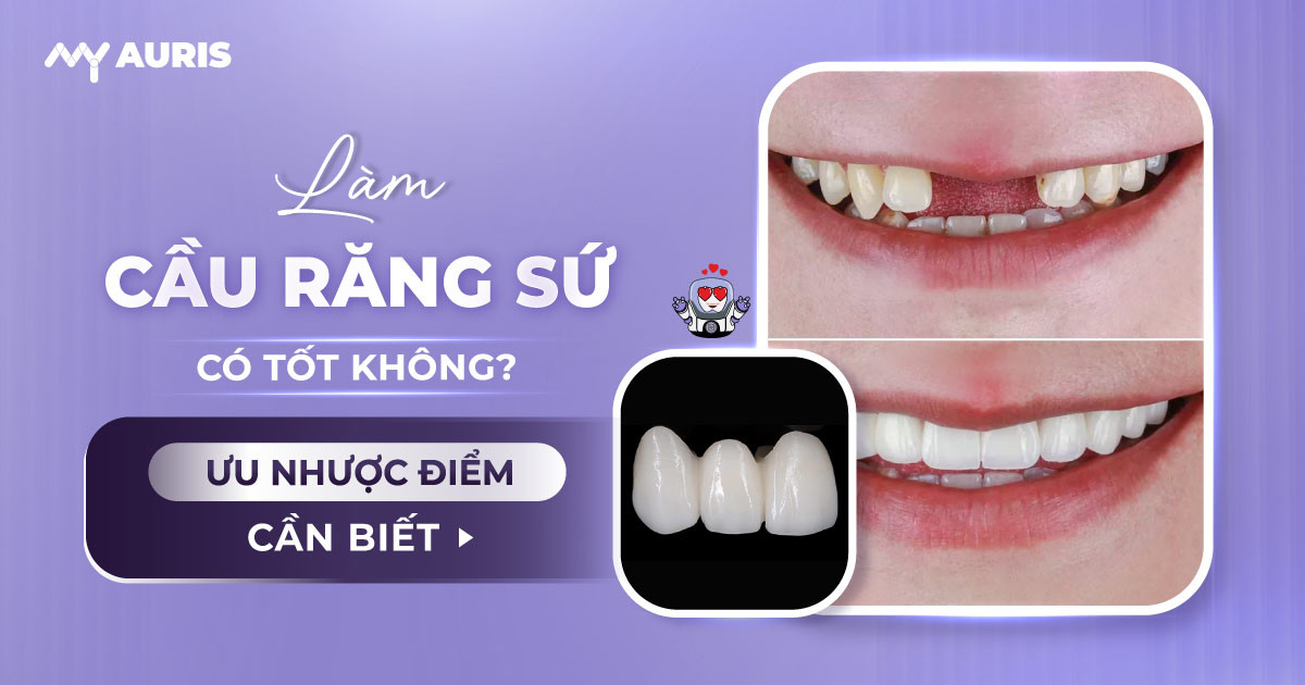 trồng răng giả bằng cầu răng sứ,làm cầu răng sứ có tốt không,nhược điểm của cầu răng sứ