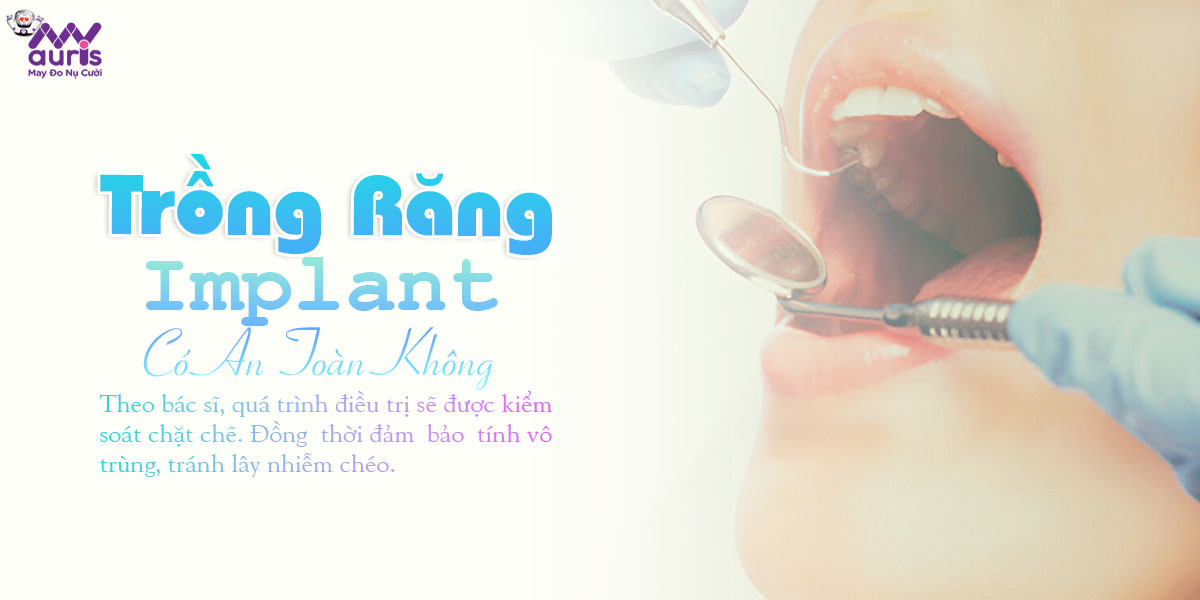 trồng răng implant có an toàn không