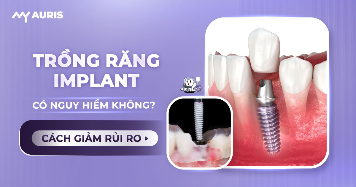 trồng răng implant có nguy hiểm không,cấy ghép răng implant có nguy hiểm không,cấy implant có nguy hiểm không,biến chứng trồng răng implant