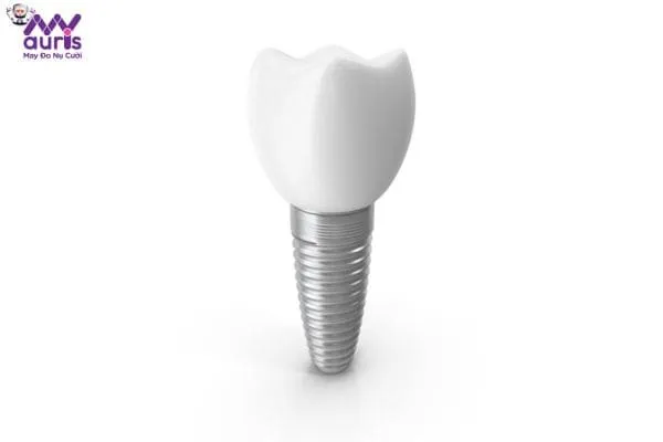 Tư vấn nha khoa: Trồng răng Implant có tốt không?