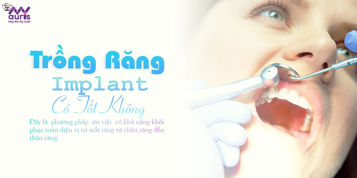 trồng răng implant có tốt không