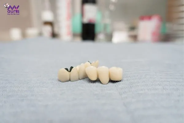  giá răng sứ thường 