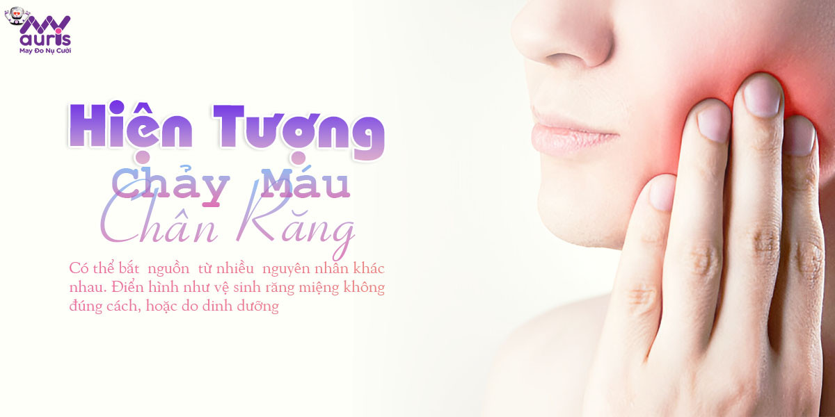 hiện tượng chảy máu chân răng