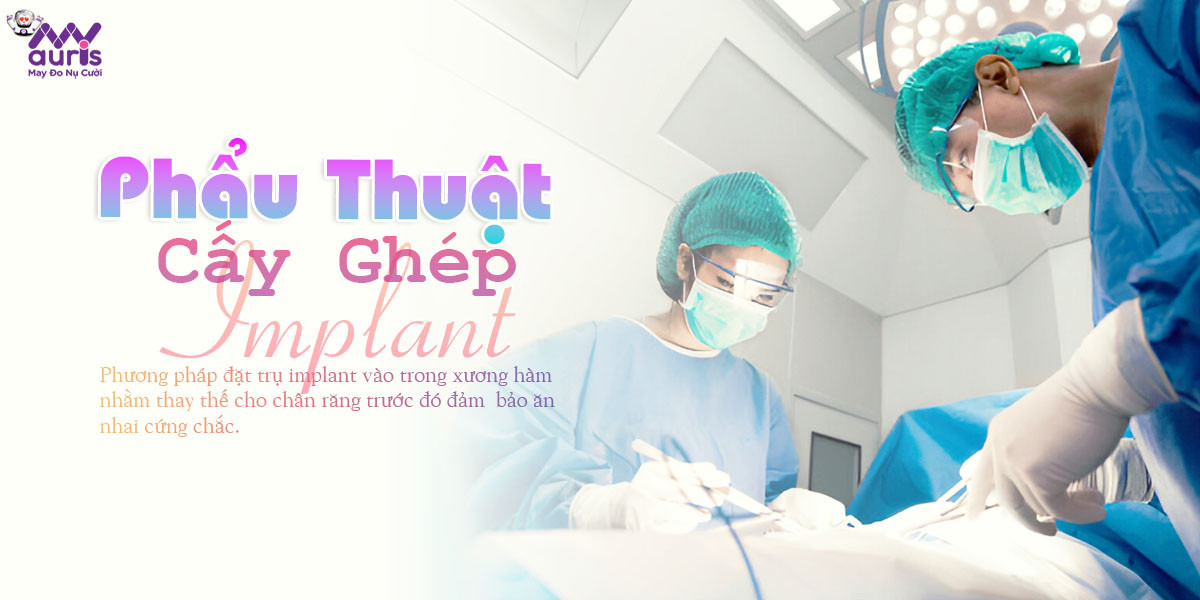 phẫu thuật cấy ghép implant