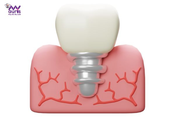  trồng răng sứ có đau không