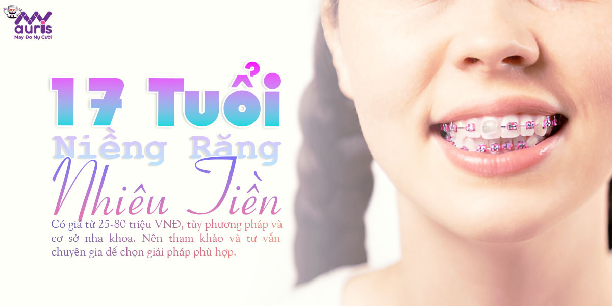 17 tuổi niềng răng bao nhiêu tiền