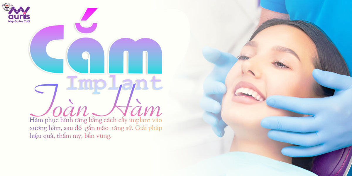 cắm implant toàn hàm