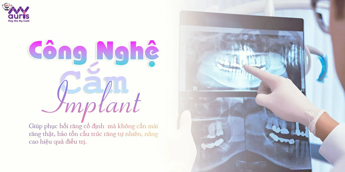 cong-nghe-cam-implant-010