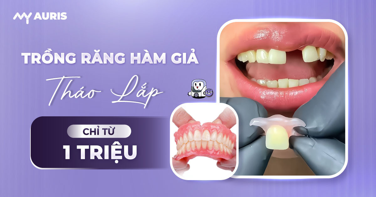 trồng răng hàm giả tháo lắp,trồng răng giả có mấy loại,trồng răng giả tháo lắp,trồng răng hàm giả,trồng răng hàm tháo lắp,trồng răng sứ tháo lắp,trồng răng tháo lắp