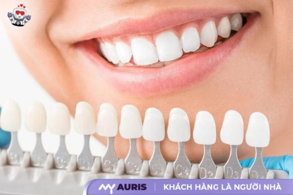 bảng màu răng sứ,màu răng sứ, răng sứ màu nào đẹp, răng sứ trắng đục