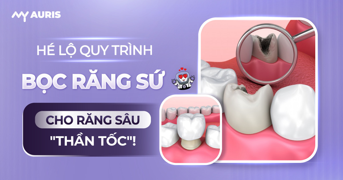 quy trình bọc răng sứ cho răng sâu, bọc răng sứ cho răng sâu