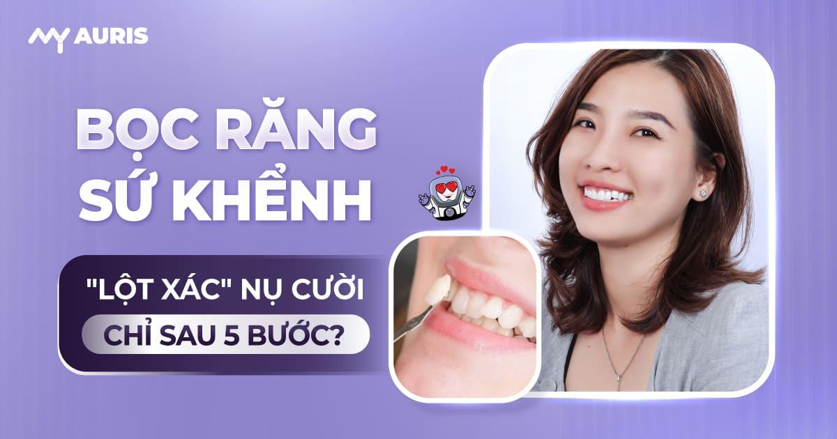 bọc sứ răng khểnh, boc su rang khenh