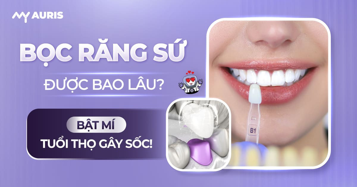 bọc răng sứ được bao lâu,cách bảo vệ răng sứ, cách chăm sóc răng sứ, sau khi bọc răng sứ nên làm gì