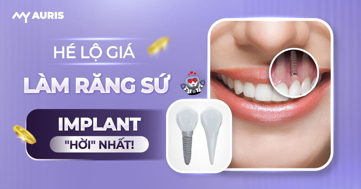 giá làm răng sứ implant