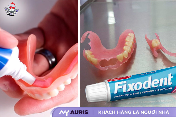 keo dán răng sứ fixodent