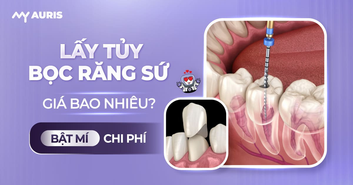 Lấy tủy bọc răng sứ giá bao nhiêu