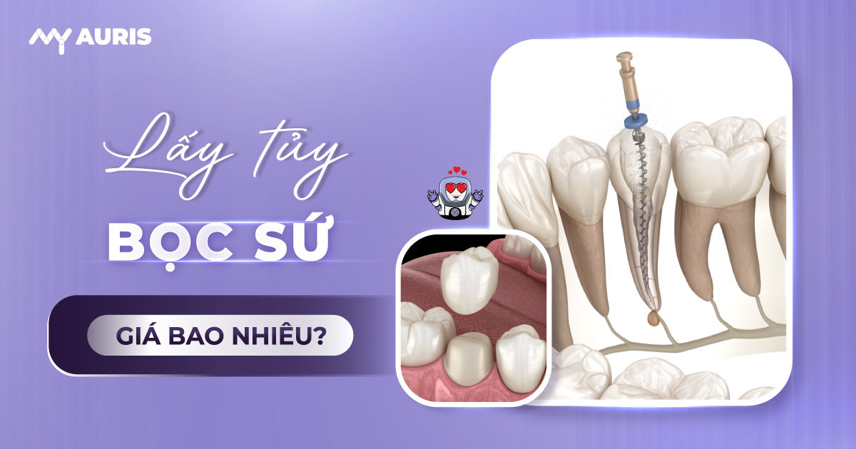 lay-tuy-boc-rang-su-gia-bao-nhieu-7-3-25