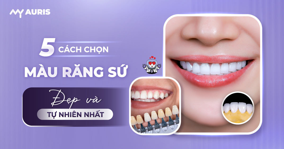 màu răng sứ đẹp nhất, răng sứ tự nhiên