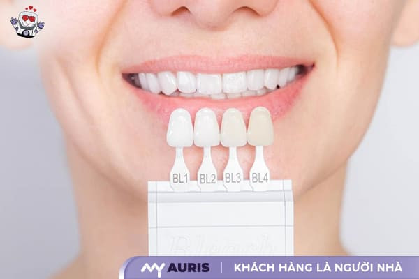 màu răng sứ tự nhiên nhất, răng sứ tự nhiên