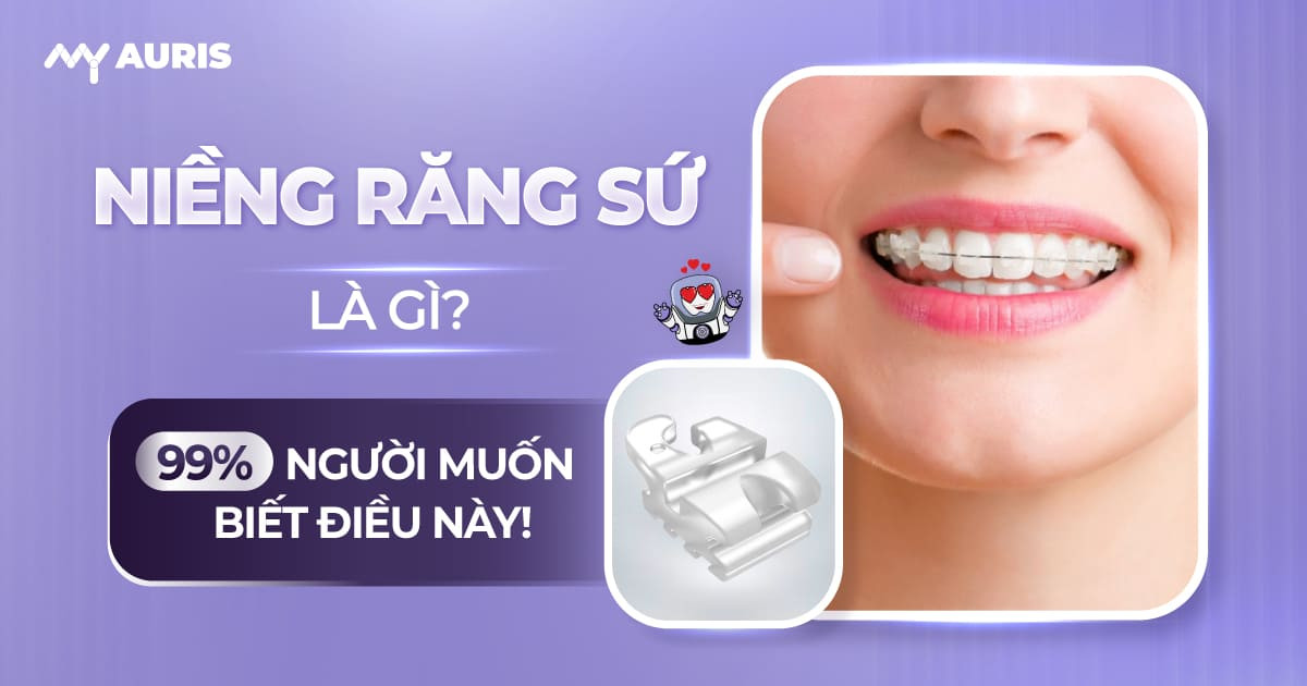 niềng răng sứ là gì, niềng răng sứ