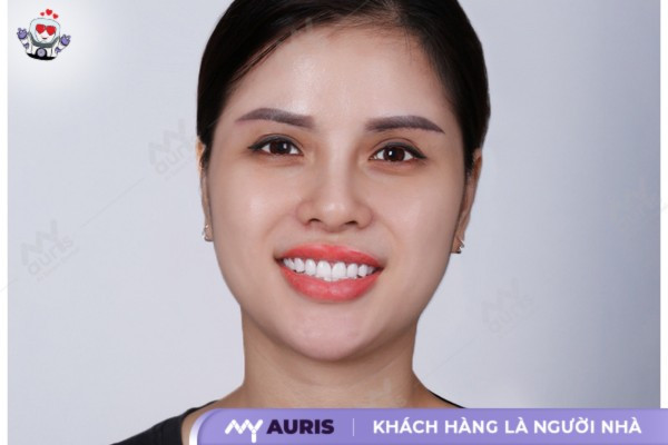 răng sứ zirconia,răng sứ zirconia có tốt không,răng sứ zirconia của nước nào