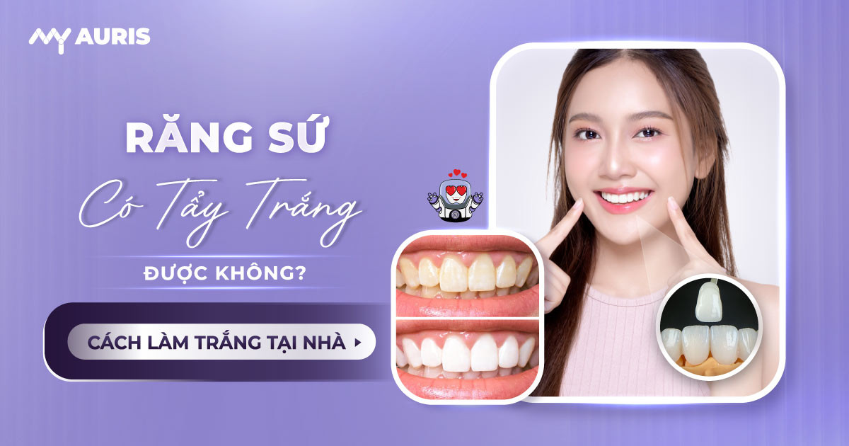 răng sứ có tẩy trắng được không