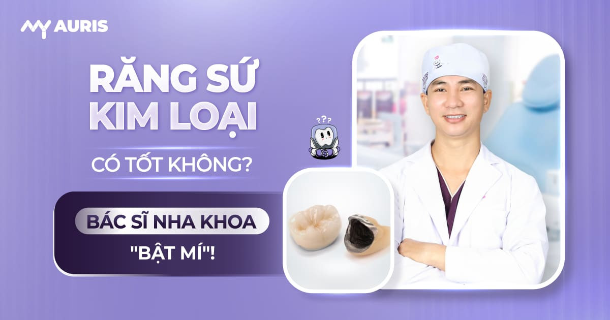 răng sứ kim loại có tốt không, răng sứ kim loại là gì, trồng răng sứ kim loại