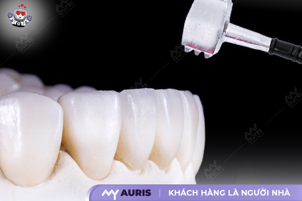 răng sứ lava plus,răng sứ lava,địa chỉ bọc răng sứ tốt,làm răng sứ ở đâu đẹp,làm răng sứ ở đâu tốt nhất,