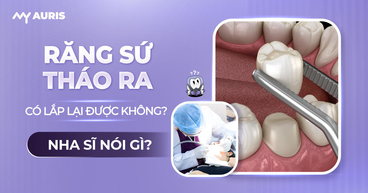 răng sứ tháo ra có lắp lại được không, bọc răng sứ có tháo ra được không,tháo răng sứ có đau không,thay răng sứ