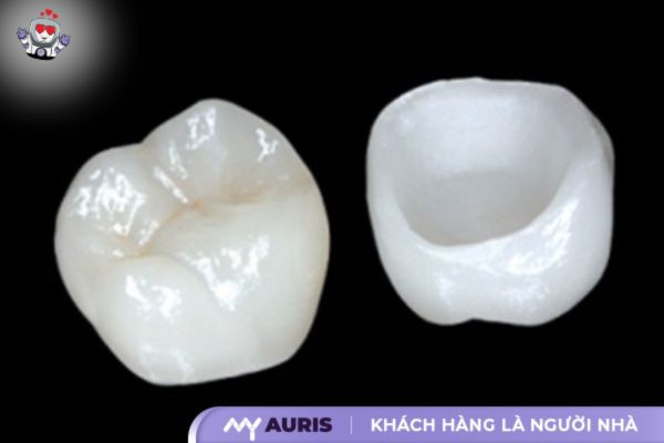 răng sứ kim loại và răng toàn sứ
