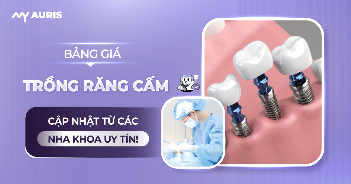 bảng giá trồng răng cấm