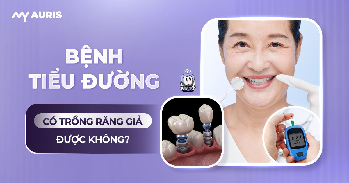 benh-tieu-duong-co-trong-rang-gia-duoc-khong