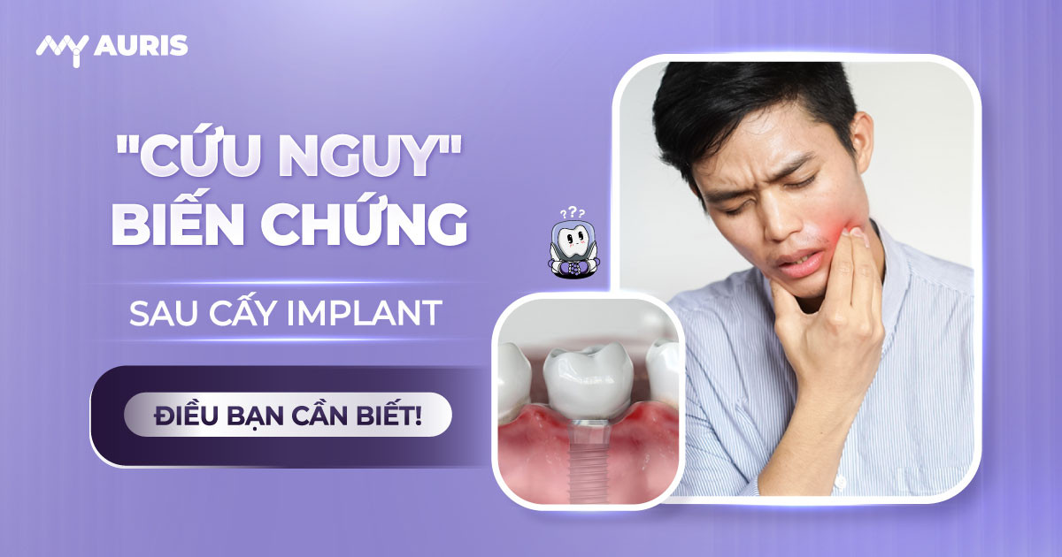 bien-chung-sau-cay-implant