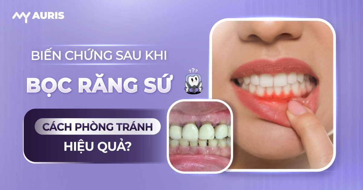 biến chứng sau khi bọc răng sứ,những biến chứng khi bọc răng sứ