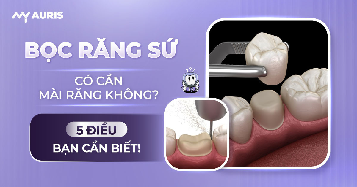 bọc răng sứ có cần mài răng không