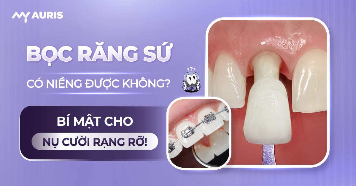 bọc răng sứ có niềng được không