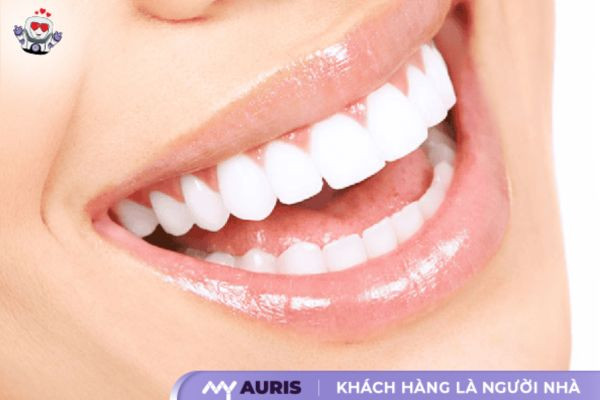 các loại răng sứ nacera