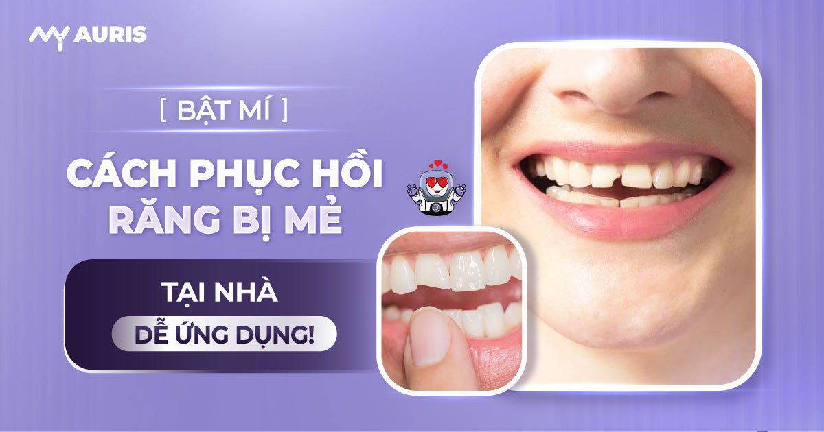 cách phục hồi răng mẻ tại nhà