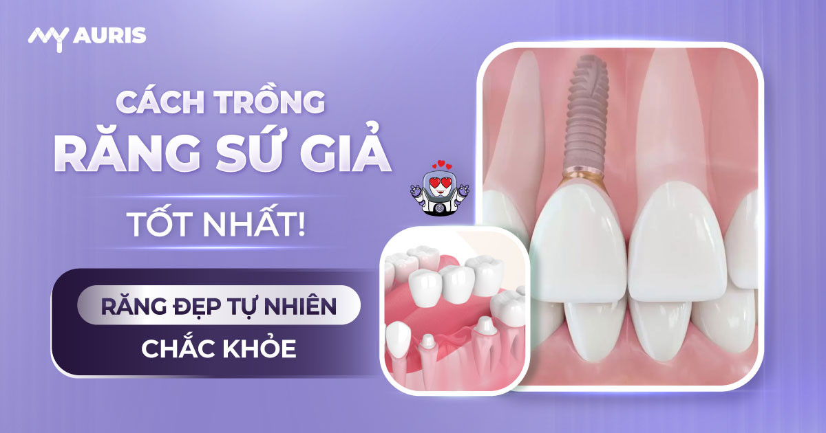 cách trồng răng sứ giả răng sứ giả