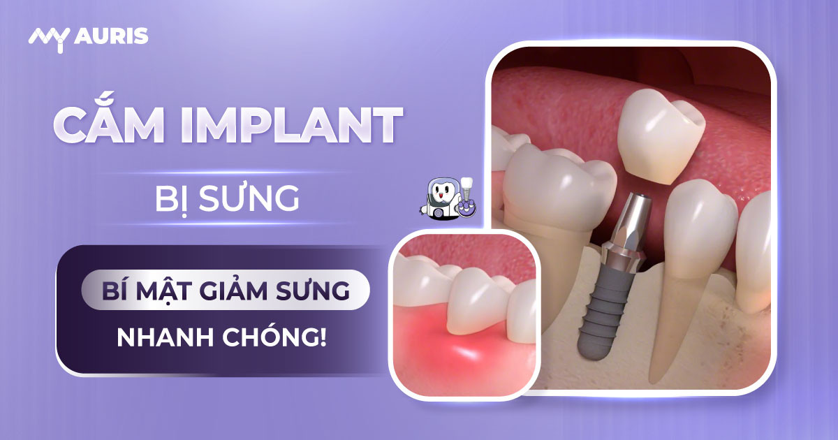 cắm implant bị sưng