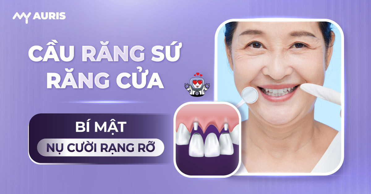 cau-rang-su-rang-cua-2-10-24