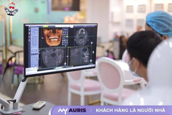 cầu răng sứ răng cửa,cầu răng sứ và implant