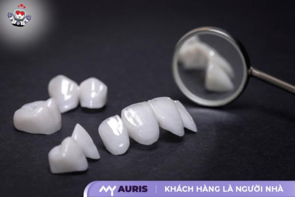 cầu răng sứ và implant