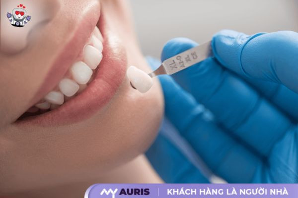 răng sứ không kim loại giá bao nhiêu,răng sứ không kim loại