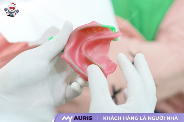 bọc răng sứ có cần mài răng không