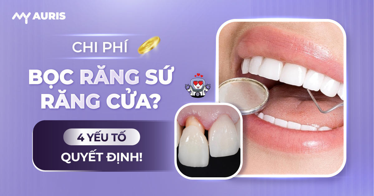 chi phí bọc răng sứ răng cửa,bọc răng sứ 4 răng cửa,làm răng sứ 4 cái răng cửa,làm răng sứ 4 răng cửa