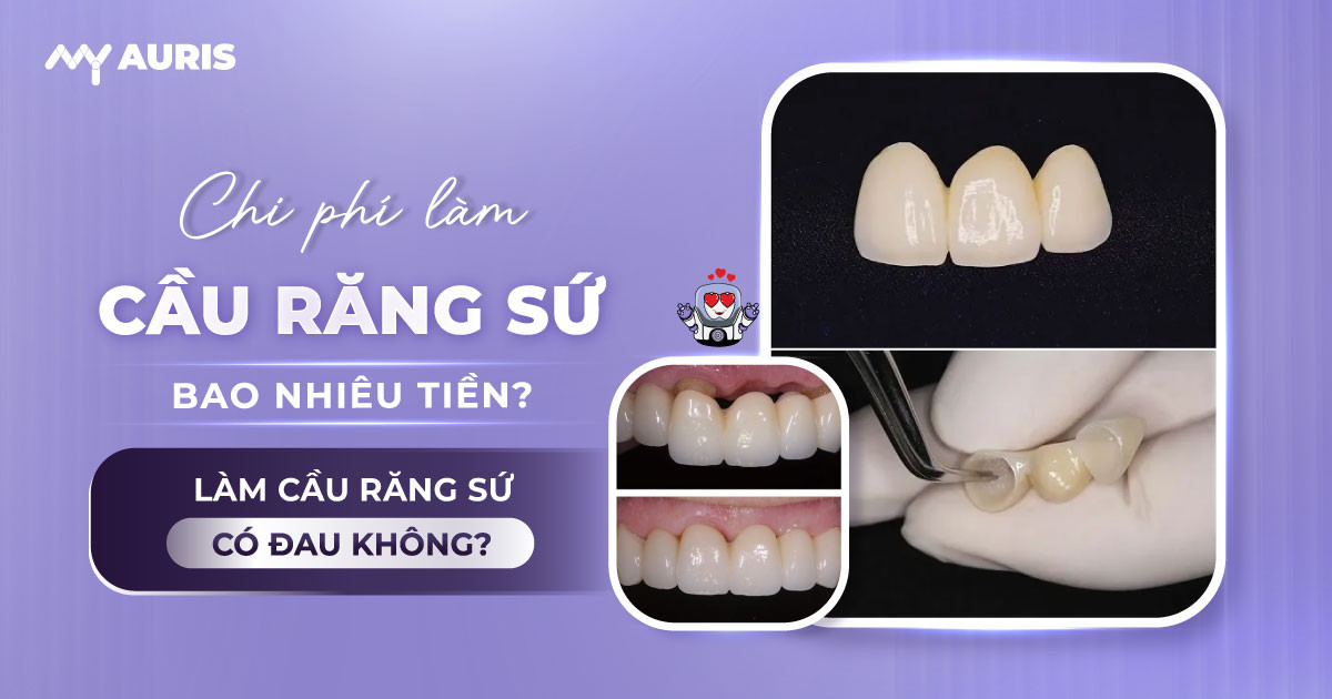 chi phí làm cầu răng sứ,giá cầu răng sứ,làm cầu răng sứ giá bao nhiêu,cầu răng sứ bao nhiêu tiền,giá làm cầu răng sứ,làm cầu răng sứ bao nhiêu tiền