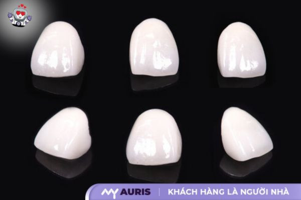 bảng giá trồng răng khểnh