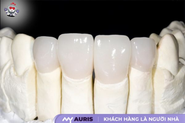 Ưu điểm và nhược điểm của răng sứ cercon ht và zirconia
